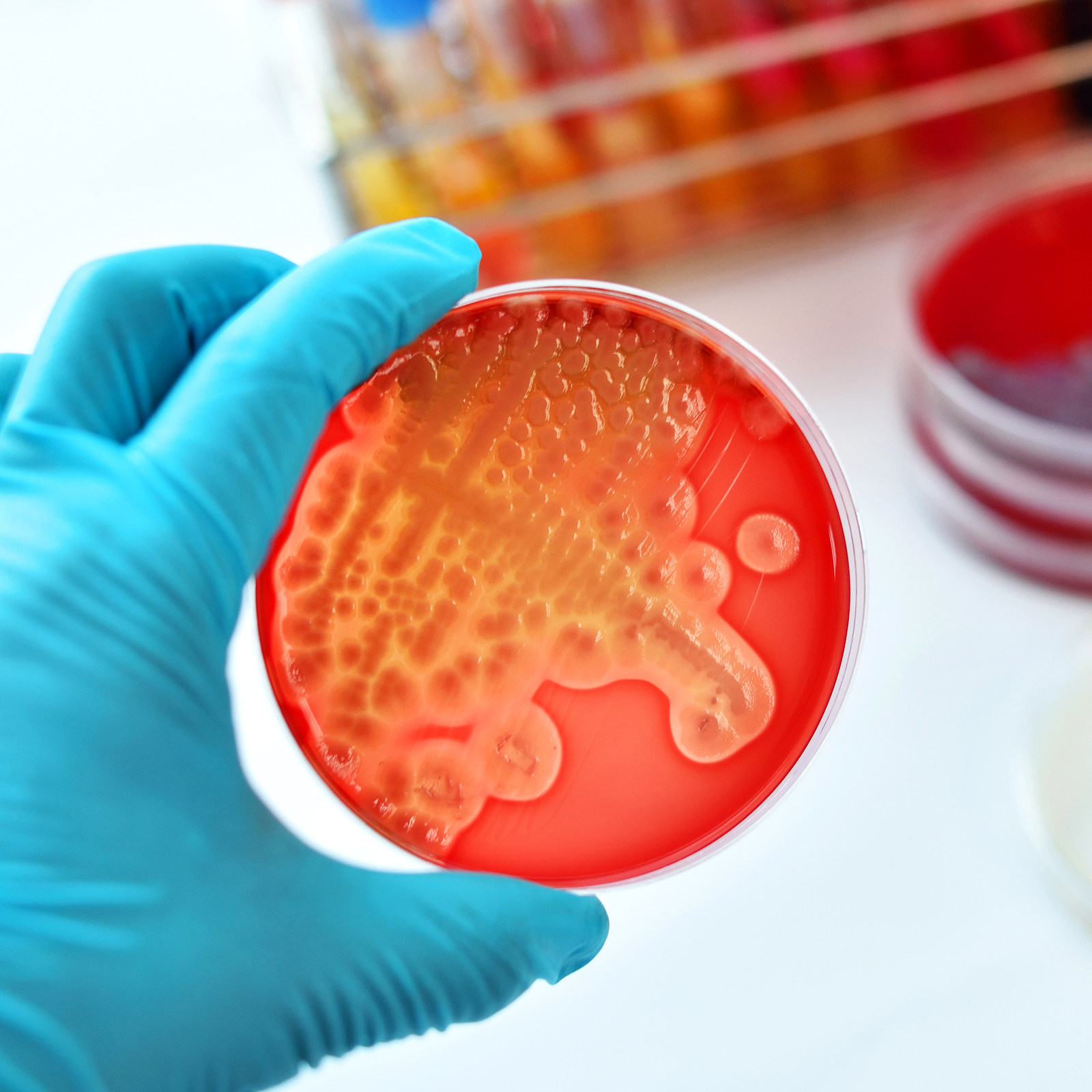 Agar Tissue Culture - 20Pcs Pre-Poured Nutrient Agar Plates Sterile